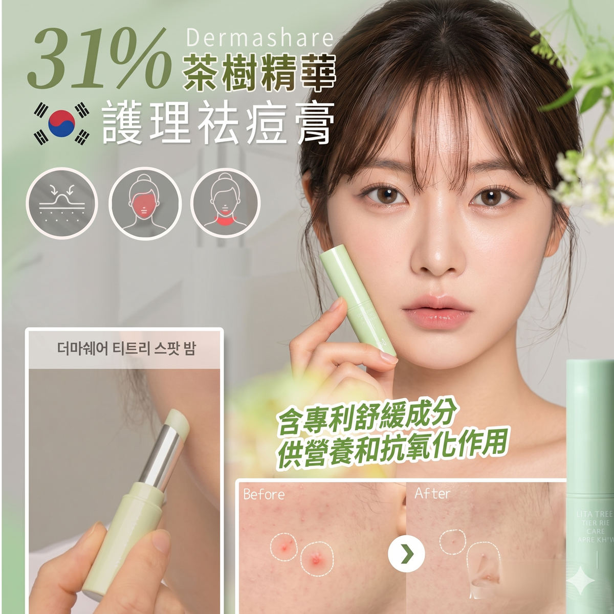 DERMASHARE - Dermashare 茶樹煩惱護理祛斑膏 3.5g 平行進口